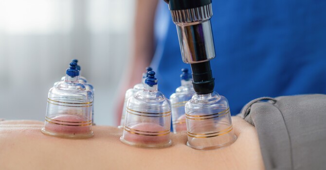 Myofascial Cupping